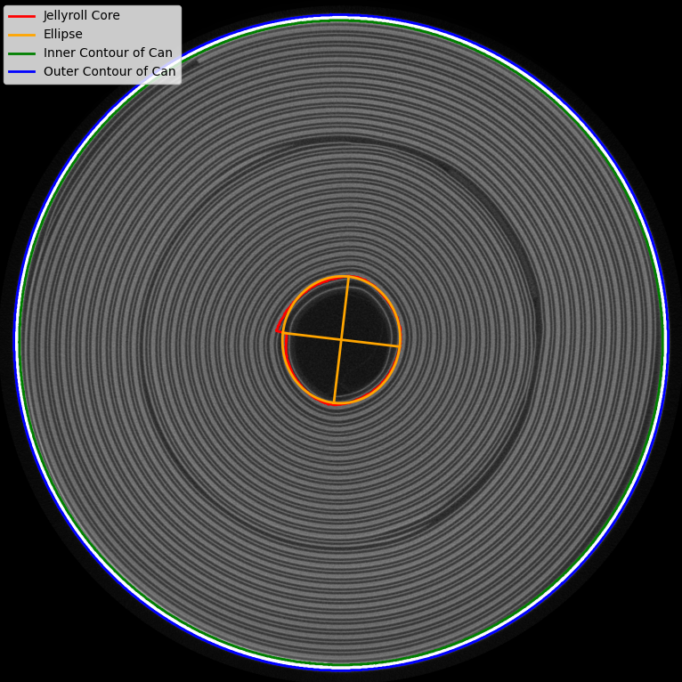 Radial Segmentation